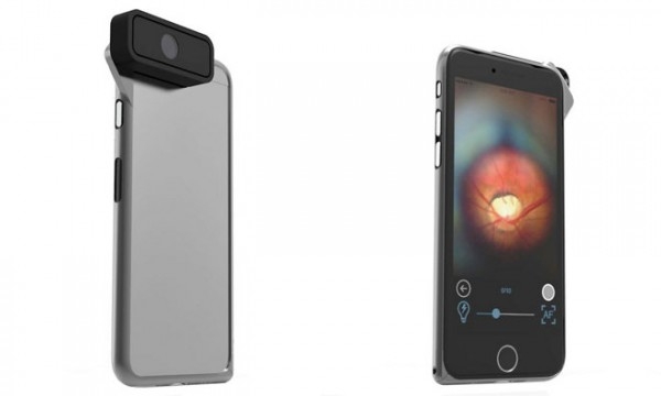 太強悍，iPhone還能檢查眼睛問題