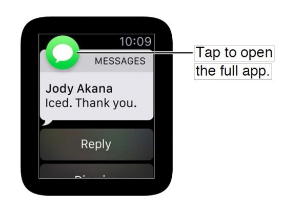 蘋果也耍流氓？Apple Watch首次遭到起訴